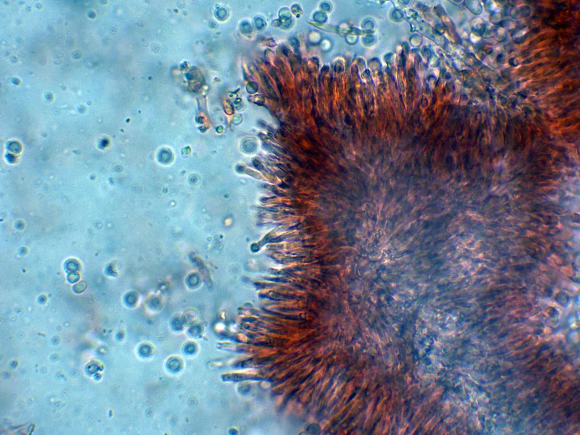 Microscopía de Nectria rubropeziza - 10 - Conidióforos-001